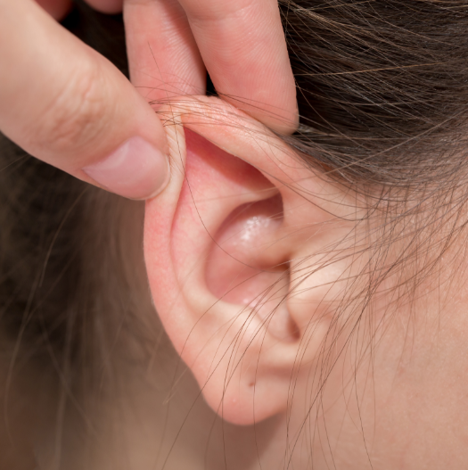 Otoplastia – cirurgia de orelha de abano